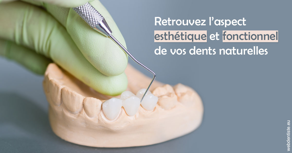 https://dr-bartmann-priscilla.chirurgiens-dentistes.fr/Restaurations dentaires 1