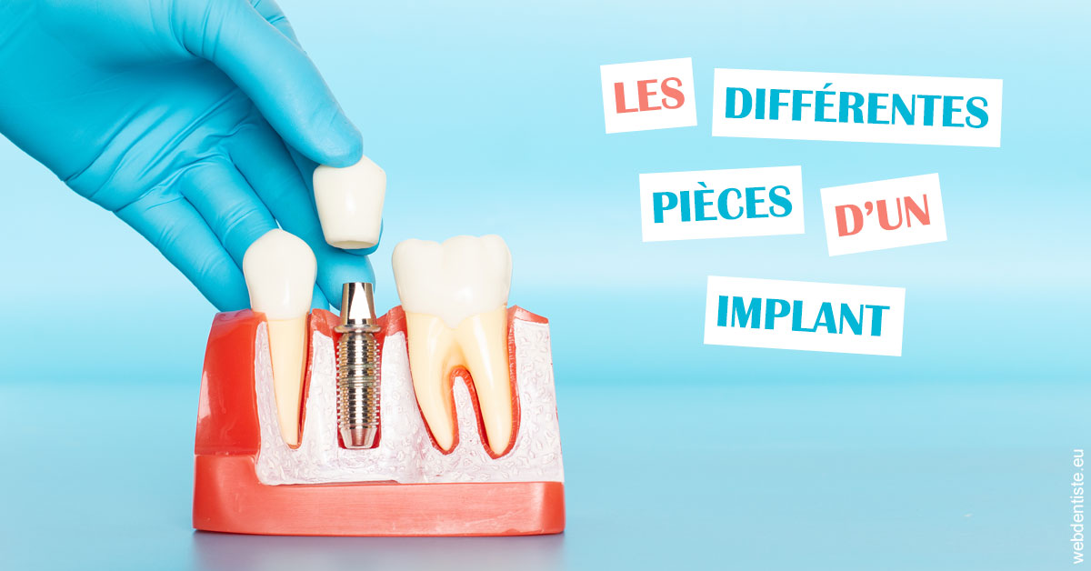 https://dr-bartmann-priscilla.chirurgiens-dentistes.fr/Les différentes pièces d’un implant 2