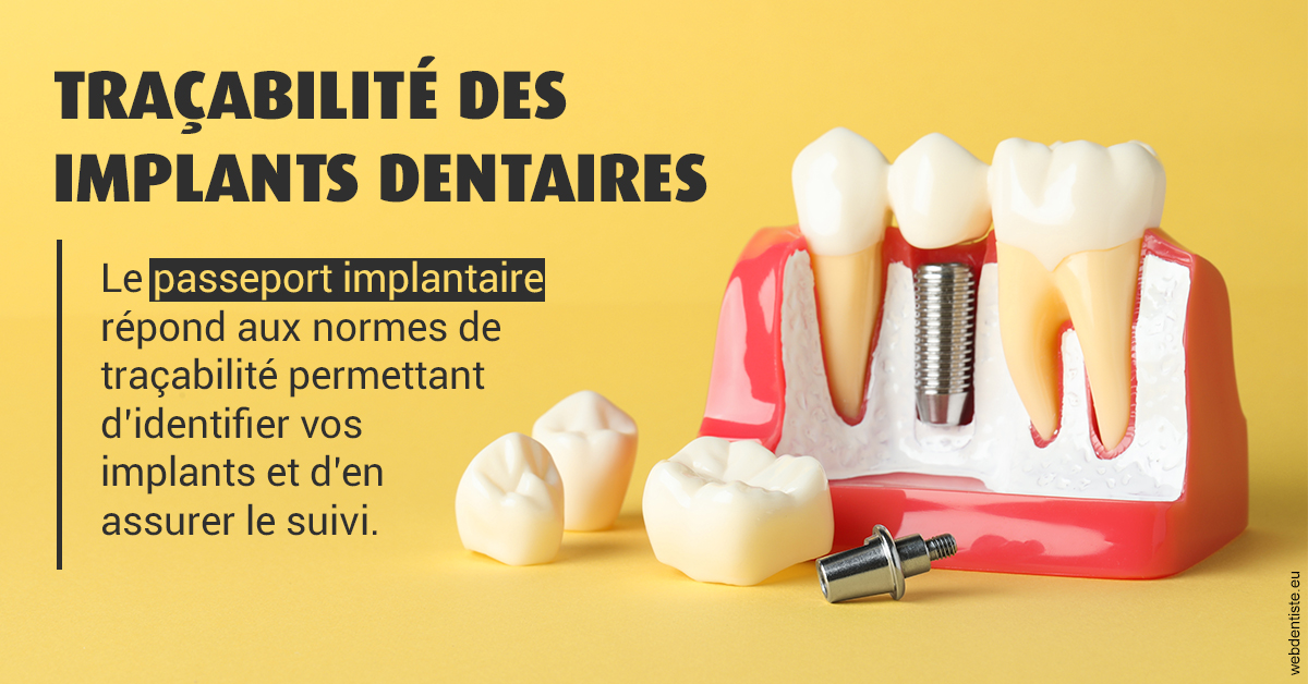 https://dr-bartmann-priscilla.chirurgiens-dentistes.fr/T2 2023 - Traçabilité des implants 2