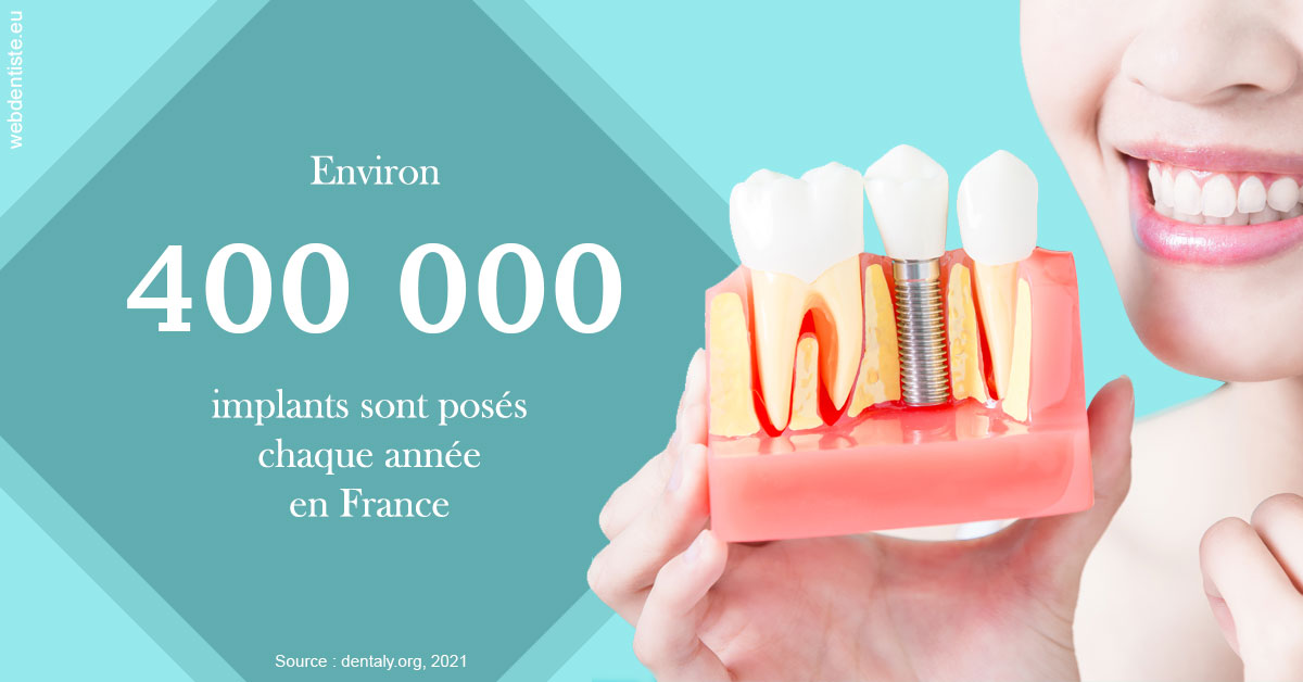 https://dr-bartmann-priscilla.chirurgiens-dentistes.fr/Pose d'implants en France 2