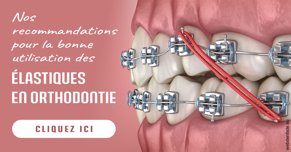 https://dr-bartmann-priscilla.chirurgiens-dentistes.fr/Elastiques orthodontie 2